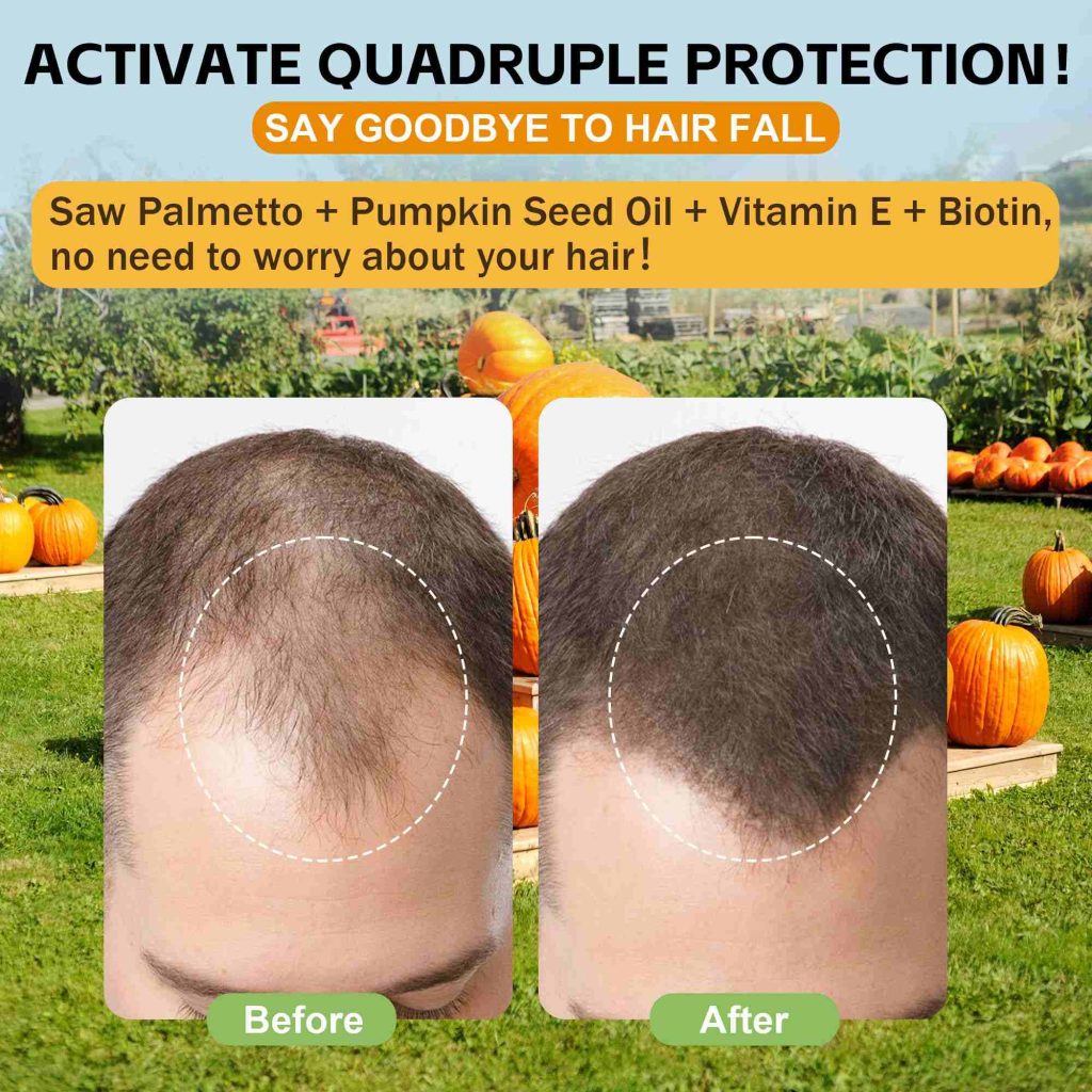best pumpkin seed oil supplements for hair growth